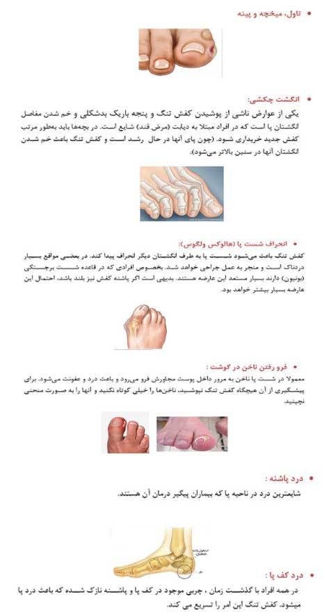عوارض کفش تنگ و پاشنه بلند عوارض کفش تنگ و پاشنه بلند